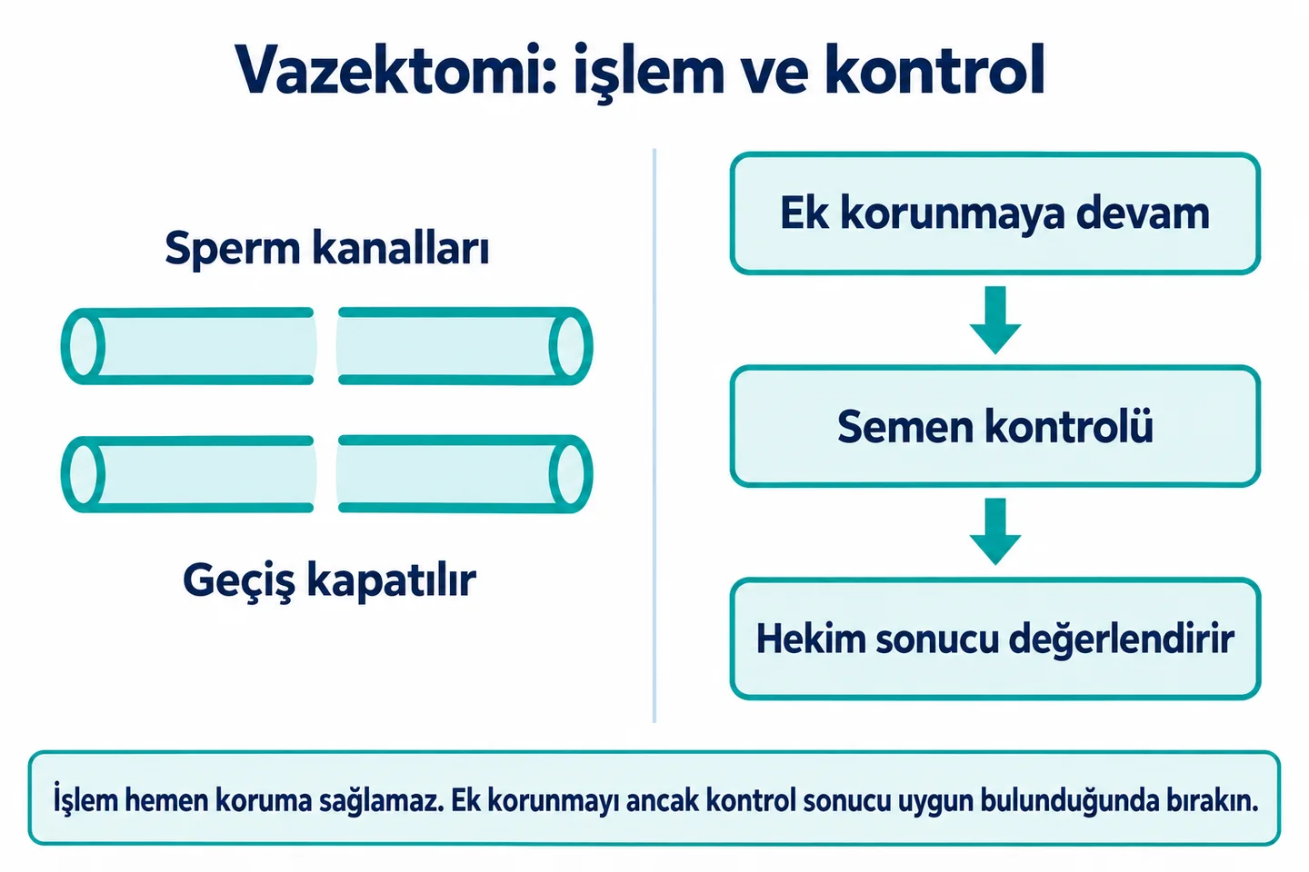 İki sperm kanalında geçişin kesilmesini, ardından ek korunma, semen kontrolü ve hekim değerlendirmesini gösteren kavramsal şema.