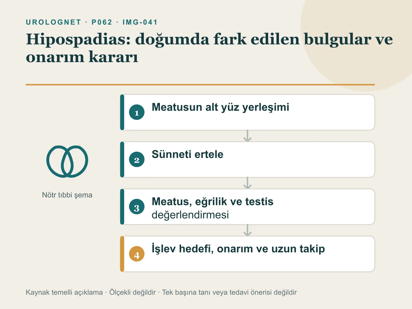 Hipospadiasta dış idrar deliğinin farklı alt yüz yerleşimlerini, kapüşon biçimli sünnet derisini, eğrilik değerlendirmesini ve sünnetten kaçınarak çocuk ürolojisine uzanan yolu gösteren şema.