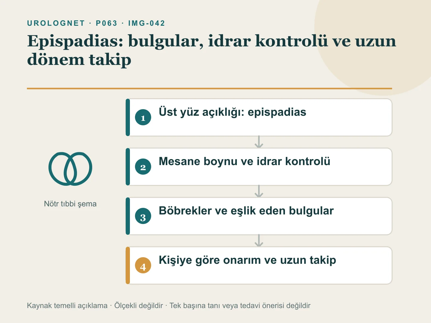 Epispadias açıklığının penis üst yüzündeki yerini hipospadiasın alt yüz yerleşimiyle karşılaştıran; izole epispadias, mesane ekstrofisi ve idrar kontrolüne göre değerlendirme ile uzun takibi gösteren şema.