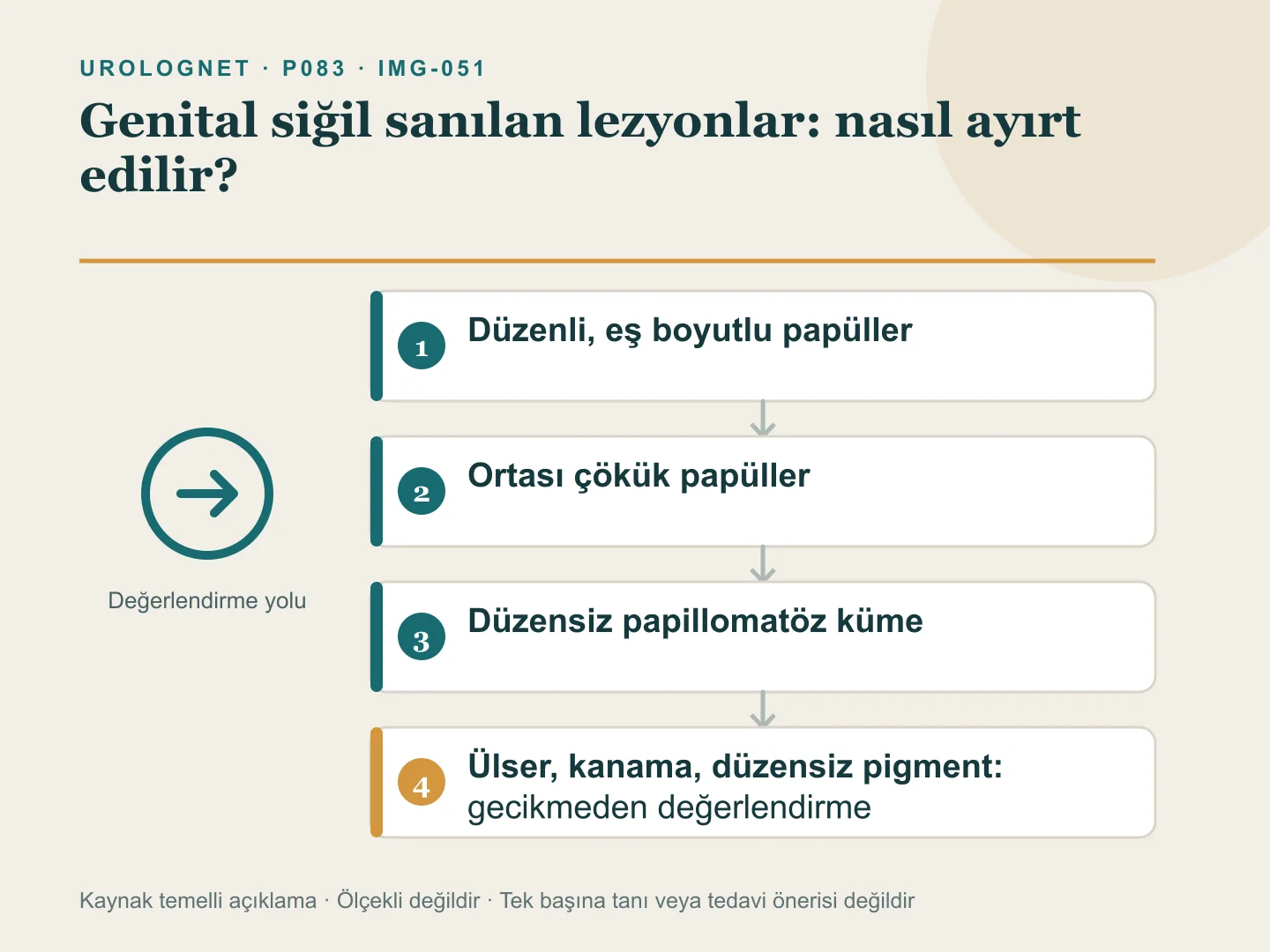 Genital bölgede siğille karışabilen düzenli papüller, ortası çökük papüller ve düzensiz yüzeyli lezyonlarla kanama ve ülser gibi uyarı bulgularını ayıran şema.