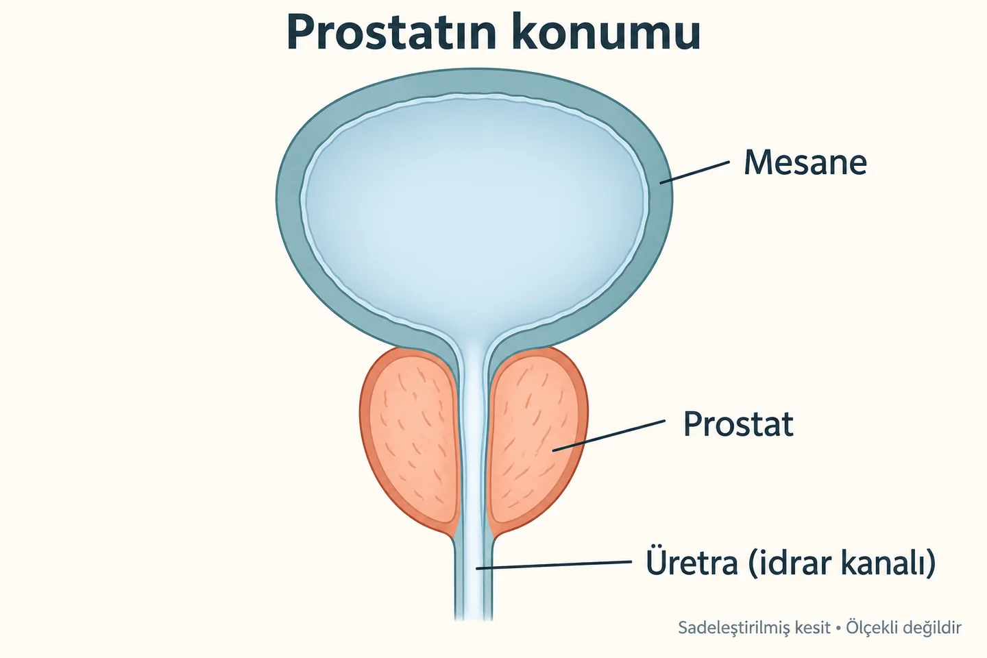 Mesanenin altında, içinden idrar kanalı geçen prostatın sadeleştirilmiş kesit şeması.