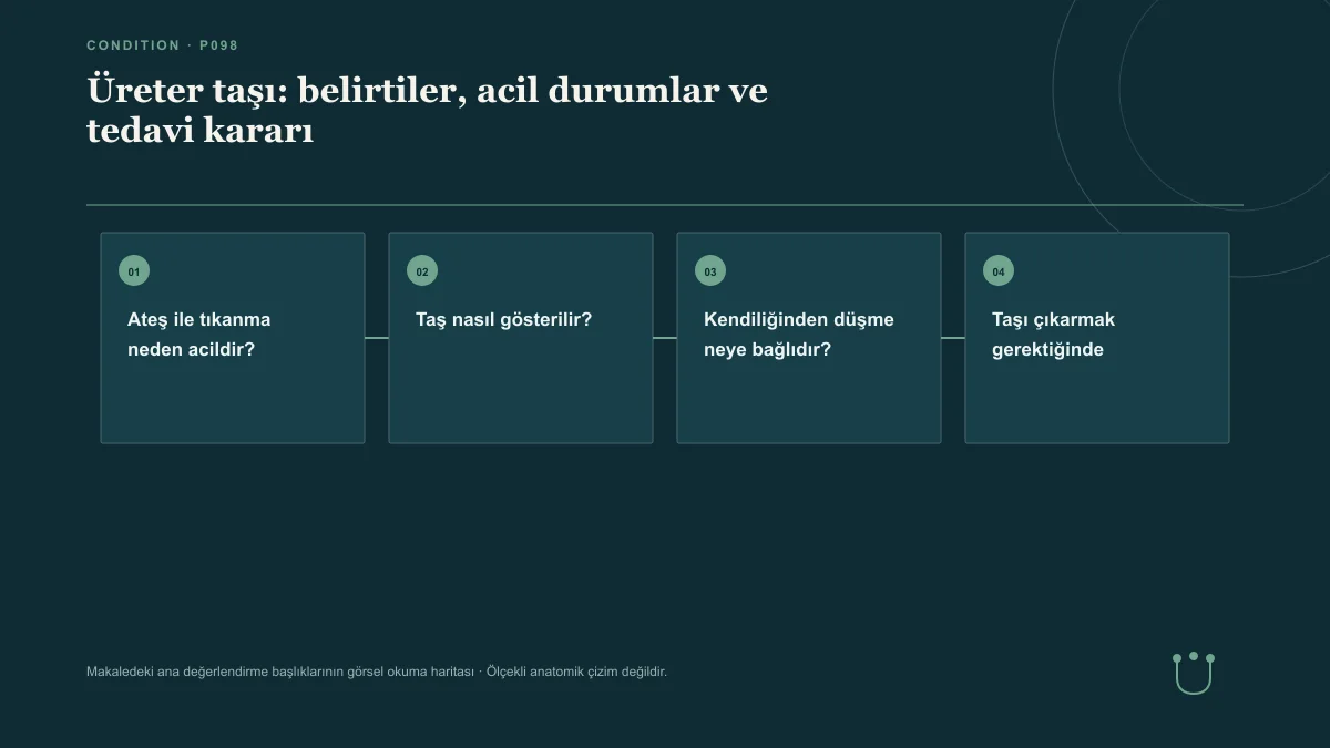 Üreter taşı: belirtiler, acil durumlar ve tedavi kararı için makalenin ana değerlendirme başlıklarını gösteren görsel okuma haritası.