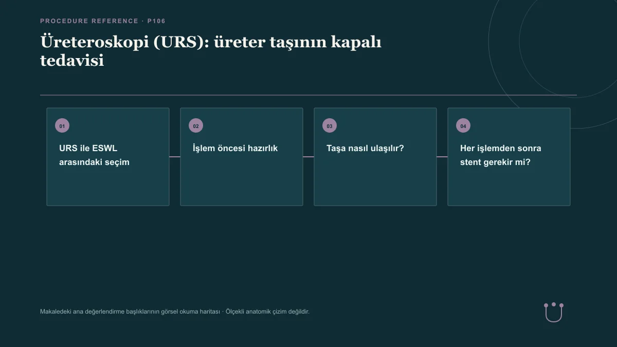 Üreteroskopi (URS): üreter taşının kapalı tedavisi için makalenin ana değerlendirme başlıklarını gösteren görsel okuma haritası.