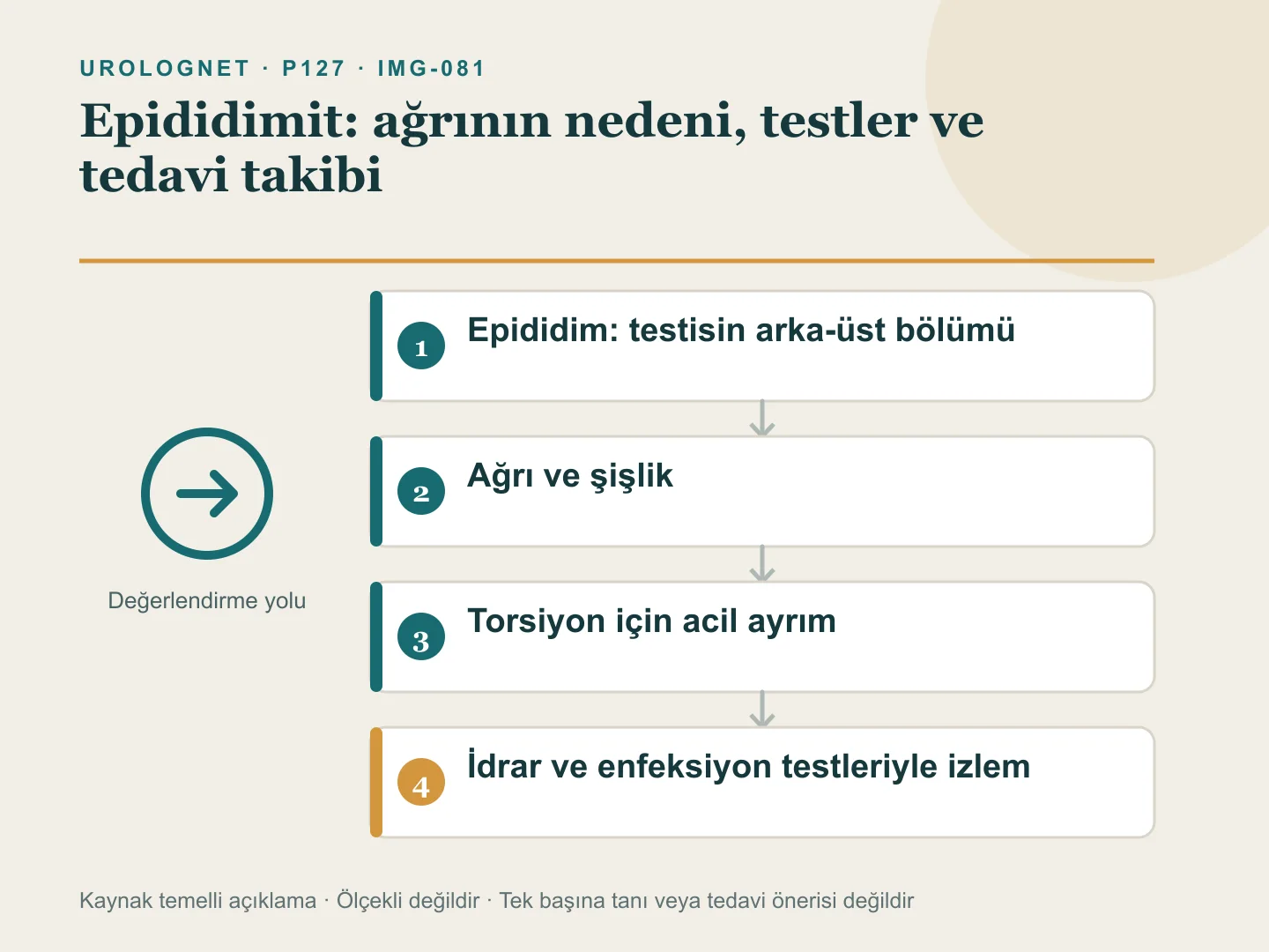 Epididimin testisin arkasındaki yerini ve testis ağrısında torsiyon ile enfeksiyon değerlendirme yollarını gösteren şema.