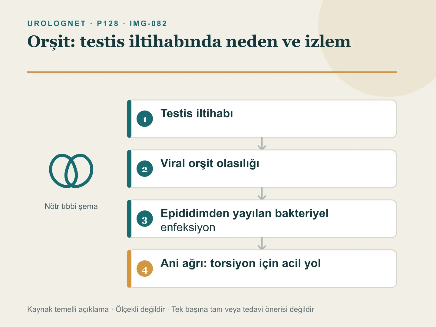 Testis iltihabında viral orşit ile epididimden yayılan bakteriyel enfeksiyonu ve ani ağrıda torsiyon çıkışını gösteren şema.