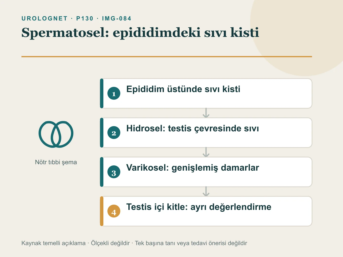 Epididimin üst bölümündeki spermatoseli hidrosel, varikosel ve testis içi kitleden ayıran anatomi ve karar şeması.