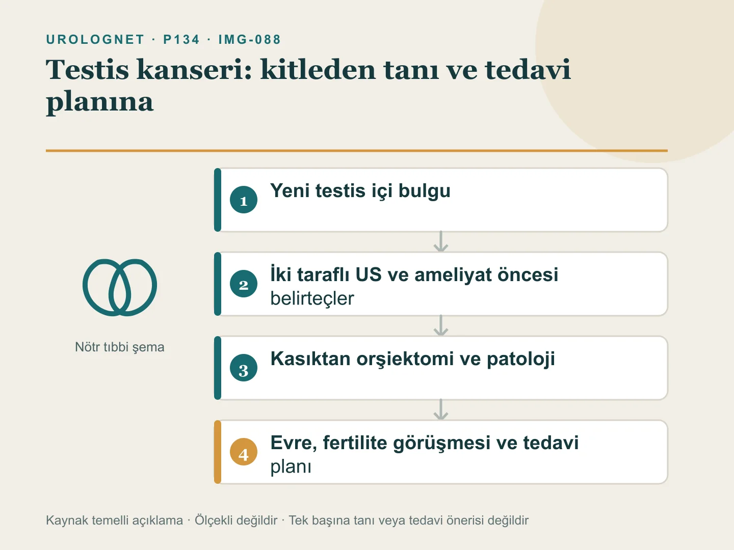 Testiste şüpheli kitleden ultrason ve tümör belirteçlerine, kasıktan orşiektomi, patoloji, evreleme ve fertilite görüşmesine uzanan karar şeması.